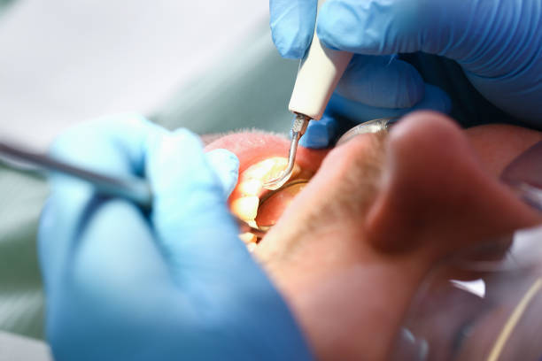 Best Emergency Tooth Extraction in Three Oaks, MI