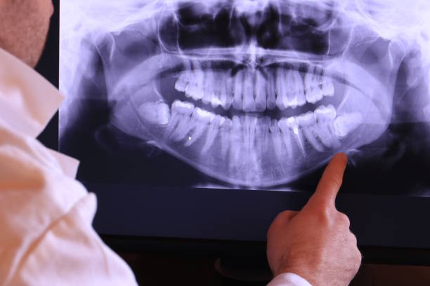 Best Emergency Wisdom Teeth Removal in Three Oaks, MI