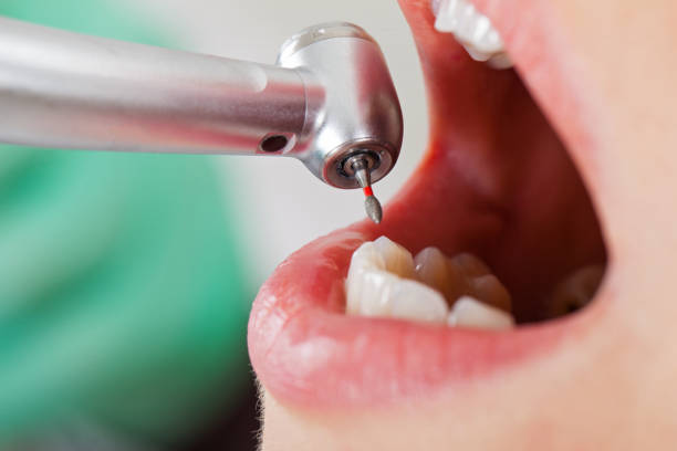 Best Emergency Tooth Extraction in Three Oaks, MI